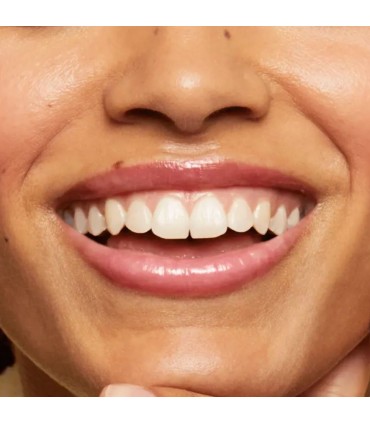 برق لب اوه سوئیت آنکالر