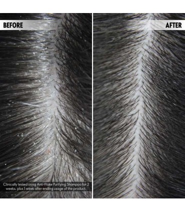 شامپو ضدشوره دئولوژی