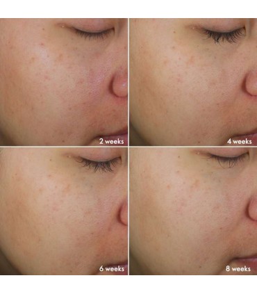 ست محصولات برایت اینتنس نوایج پلاس